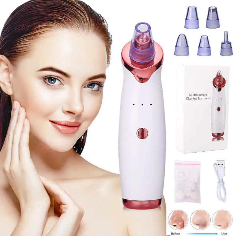 🌟Blackhead Remover Acne Vacuum Suction Face Clean PHONAX SERVICES